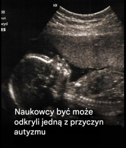 Bardzo interesujące!