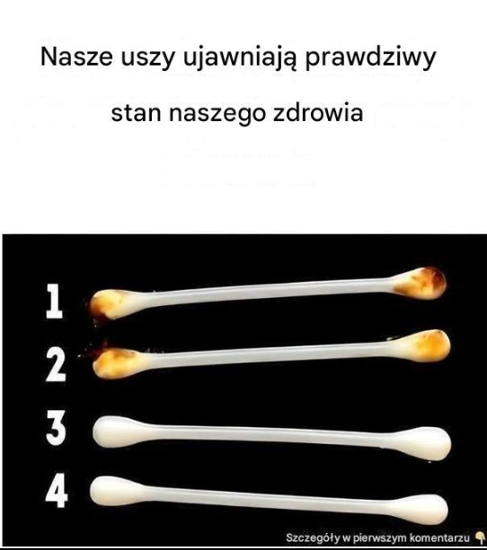 Nasze uszy ujawniają prawdziwy stan naszego zdrowia