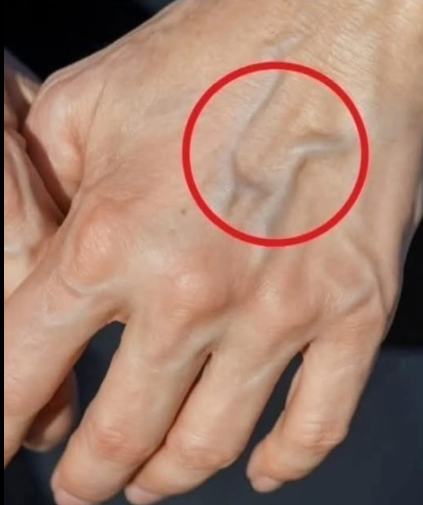 Naturalne sposoby na poprawę zdrowia żył i skóry