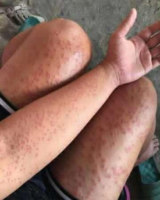 Spędziłem kilka nocy w poprzednim mieszkaniu mojego przyjaciela i zobaczyłem te niezwykłe guzy