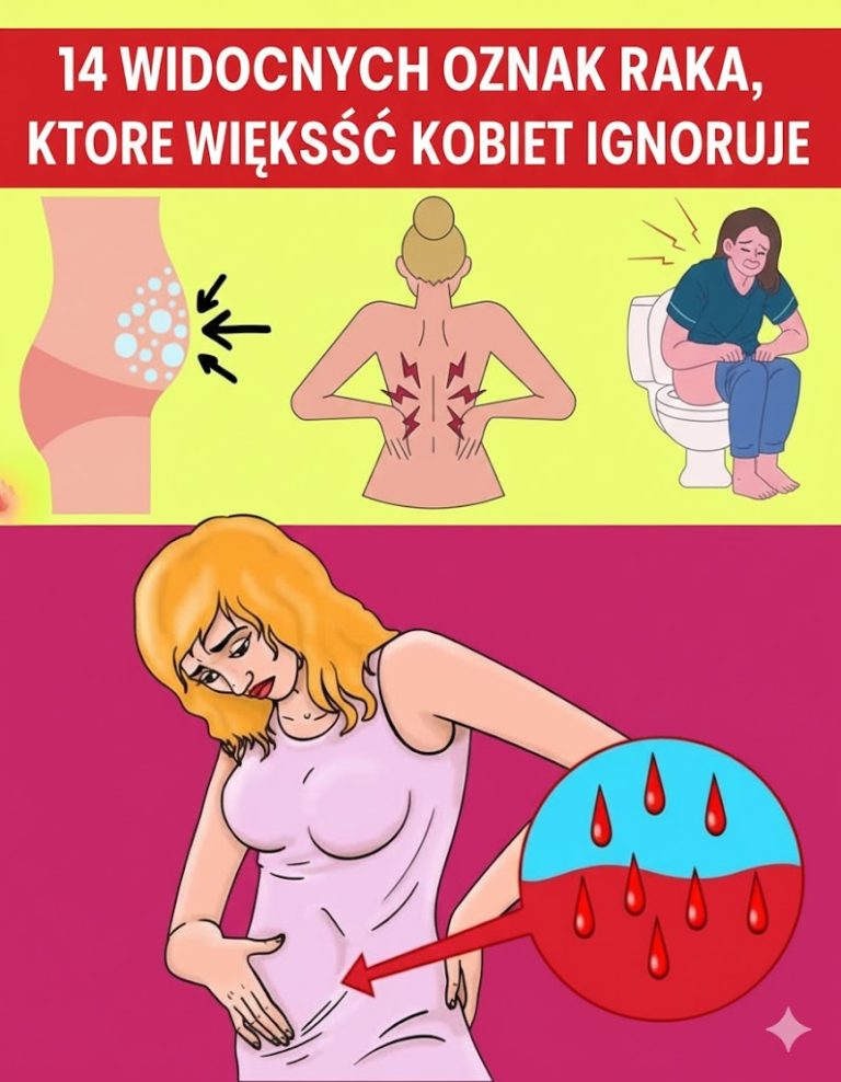 14 widocznych oznak raka, które większość kobiet ignoruje