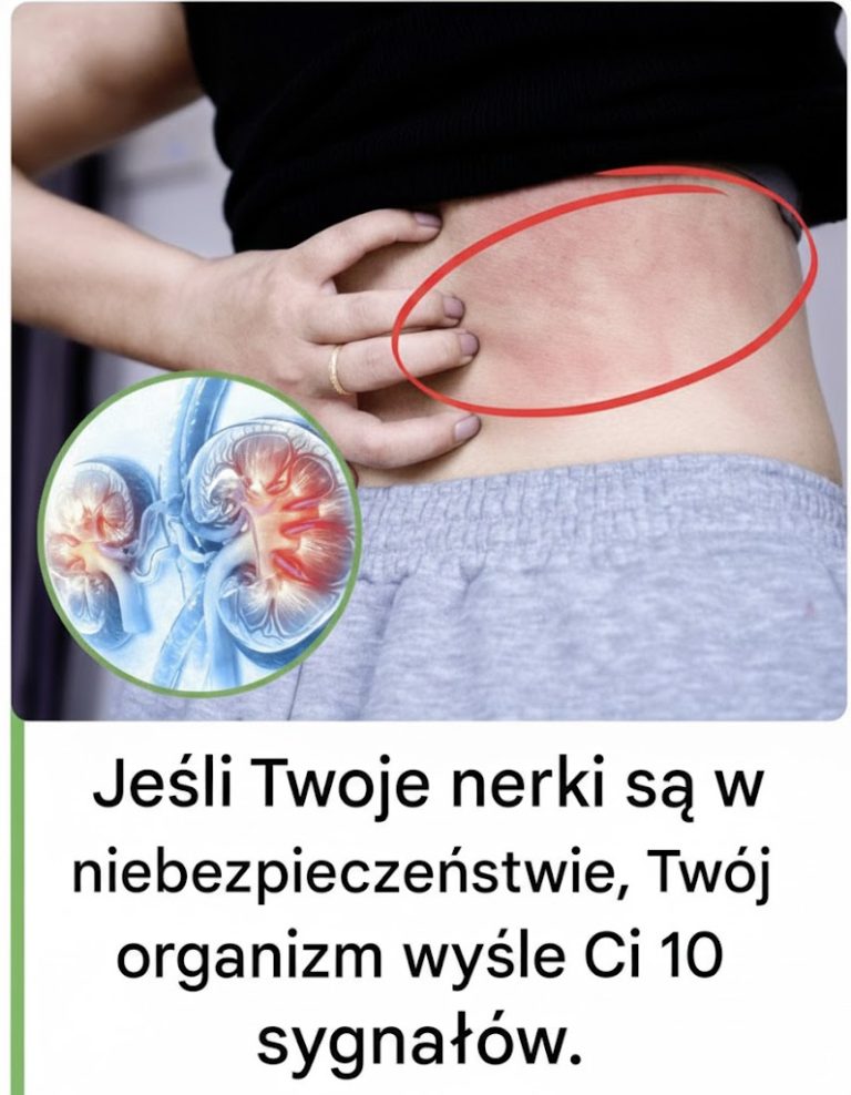 Twoje ciało wyśle ​​Ci te 10 znaków, jeśli Twoje nerki są w niebezpieczeństwie